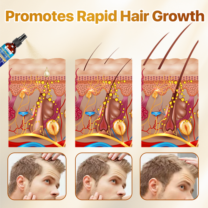 Biancat™ HairRevive Hair Growth Spray