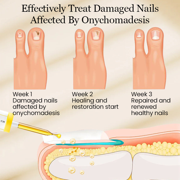 Biancat™ FungiMax Nail Herbal Antifungal Solution