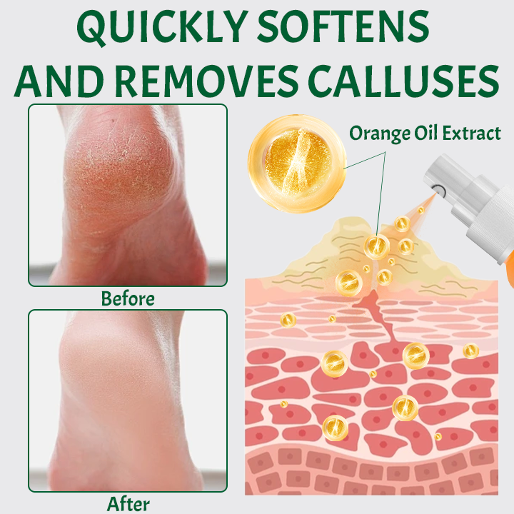 Ceoerty™ SmoothFeet Callus Remover Spray