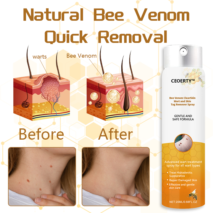 Ceoerty™ Bee Venom ClearSkin Wart and Skin Tag Remover Spray