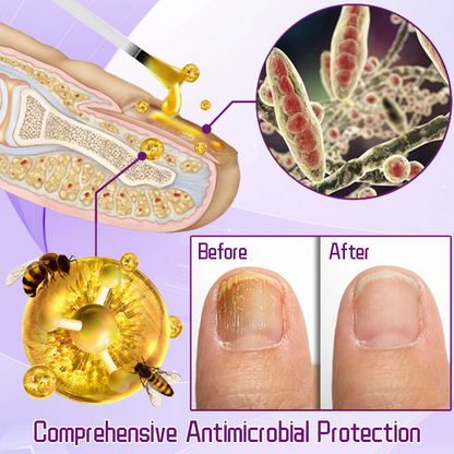 Ceoerty™ FungiShield Bee Venom Toenail Serum