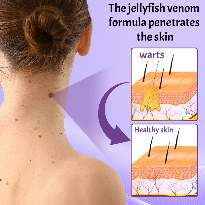 Ceoerty™ HydraVenom Skin Tag Eliminator