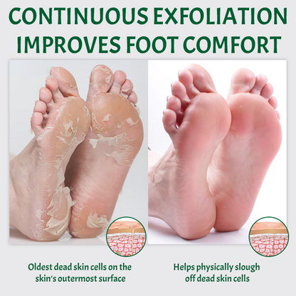 Ceoerty™ SmoothFeet Callus Remover Spray