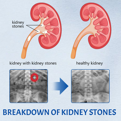 Ceoerty™ NephroFlex Kidney Boost Patch