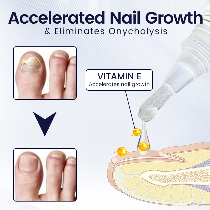 Ceoerty™ All-in-One Nail Strengthening Essence Pen