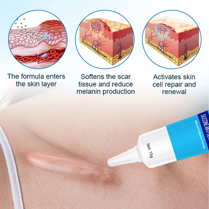 Biancat™ Silicone Anti-Scar Cream