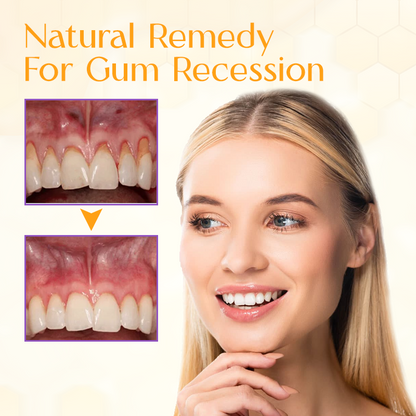 Biancat™ SmileRejuv Propolis Gum Restoration Gel